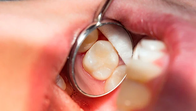 AdobeStock_187063042.jpg (Bild: Сергей Кучугурный - stock.adobe.com)